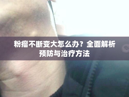 粉瘤不断变大怎么办?全面解析预防与治疗方法