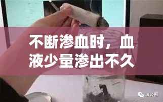 不断渗血时,血液少量渗出不久即自行凝固