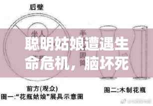 聪明姑娘遭遇生命危机,脑坏死谜团待解